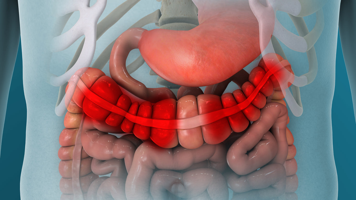 Fecal Calprotectin Test: The Key to Distinguishing IBD from IBS